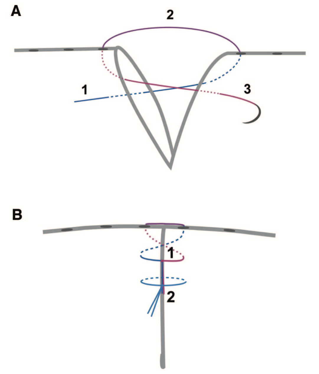 Eyelid Laceration Repair